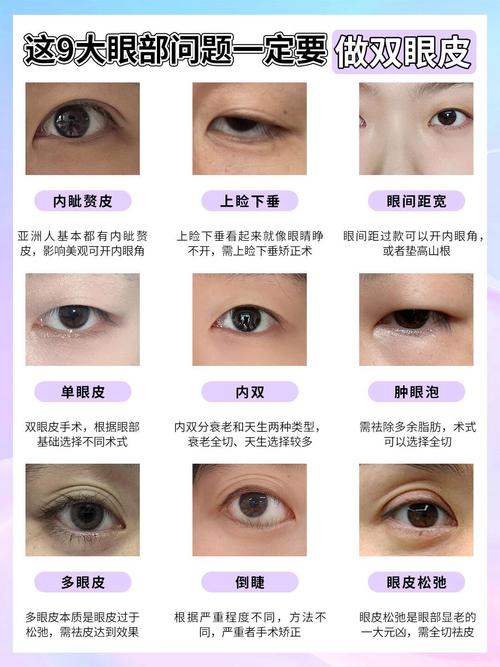 双眼皮手术会对人的命运和性格产生怎样的影响呢？