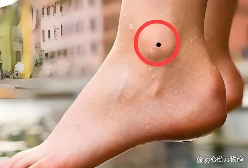 女人左脚脚踝有痣，是否预示着某种特殊命运？