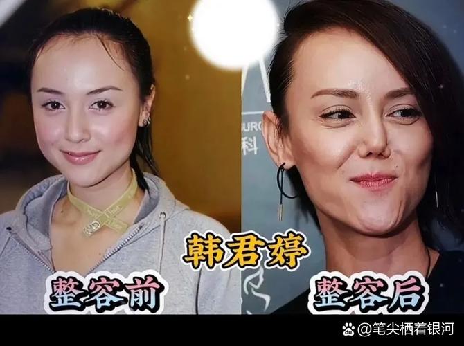 整容后命运和命格是否会发生改变？