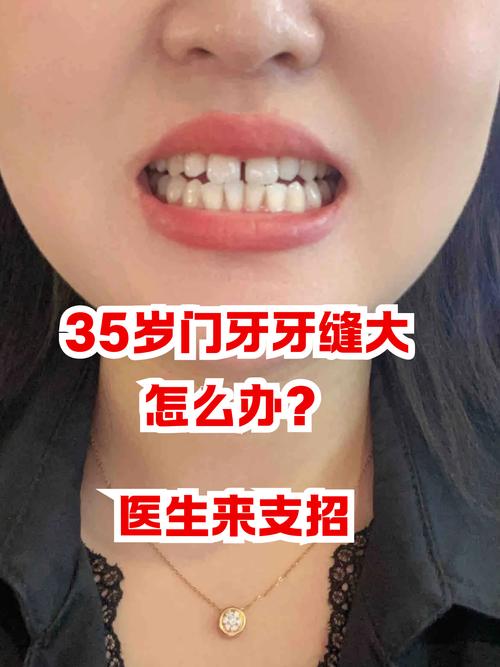 门牙特大或两个门牙大的人命运如何，有何特殊寓意？