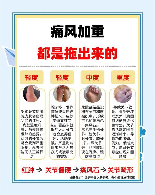 痛风水肿患者嫩否使用螺内酯来缓解症状？