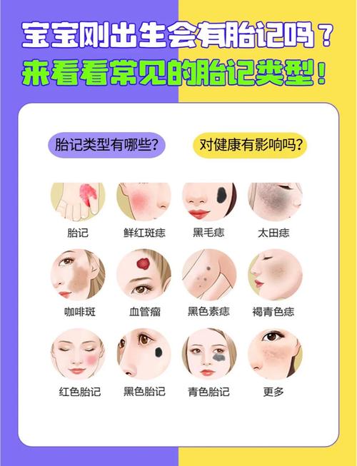 脸上胎记命运图解是什么意思？