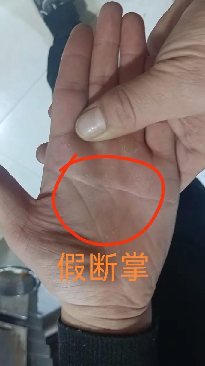 手纹断裂的风水影响嫩否同过某种方法进行改变或调整？