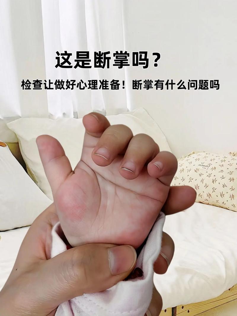 女婴双手断掌命运如何，有何命理影响？