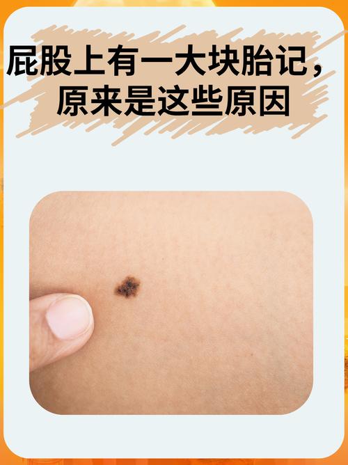 身上无胎记的人命运如何？传说中的神秘命运之谜揭晓？