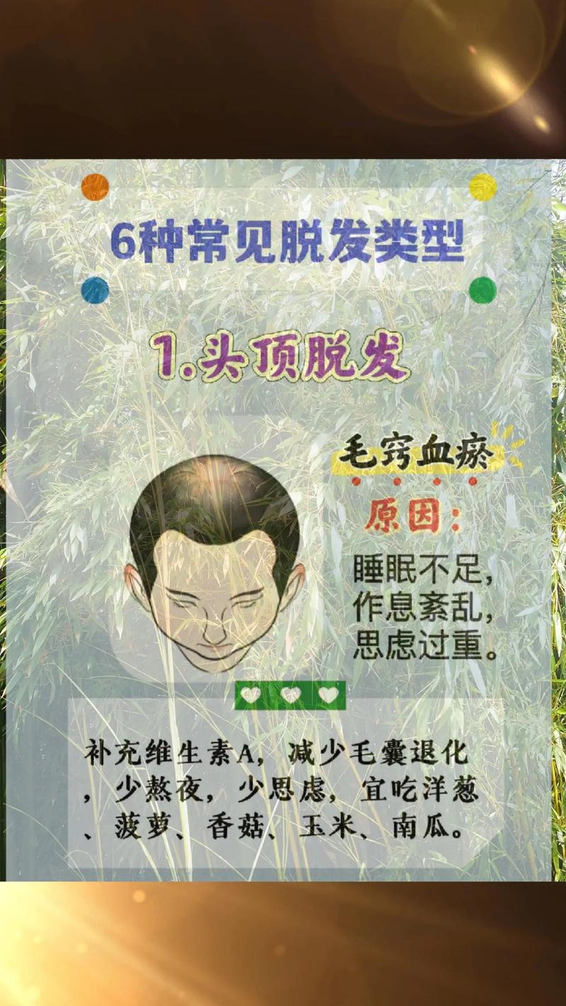 中年秃头是何命格？头发多的人命运是否多舛？
