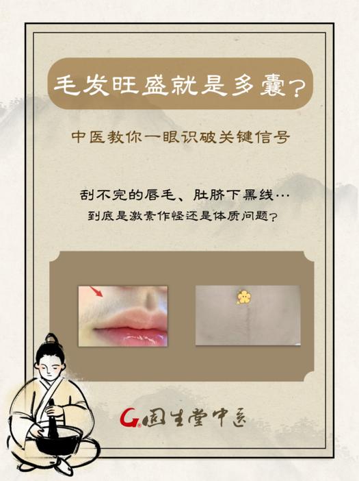 女人全身长毛命运如何？天生汗毛多女子命运会怎样？