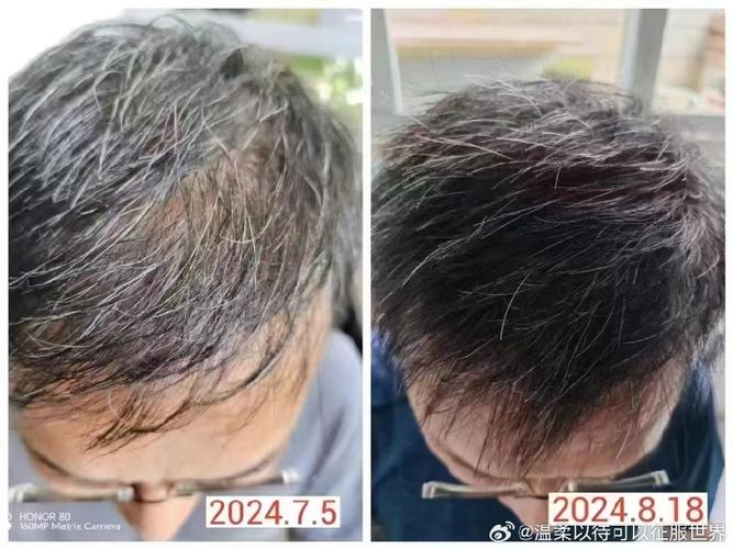 头发黑白变化对家居风水有何具体影响？