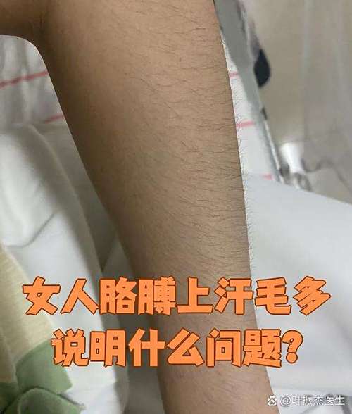 汗毛多的人命运如何？手臂汗毛多的女人命运会怎样？