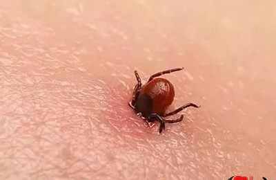 梦见身上长虫