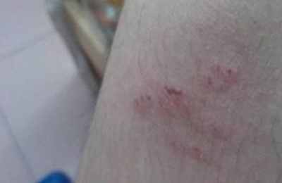 梦见被老鼠咬到手