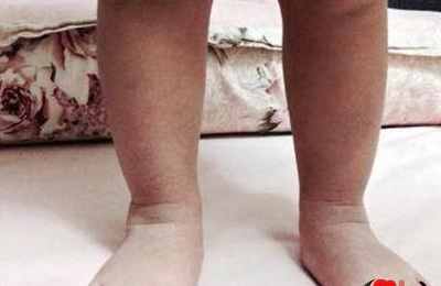 梦见光脚走路扎脚